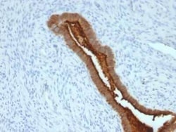 MUC1 Antibody (SPM492), Novus Biologicals:Antibodies:Primary Antibodies