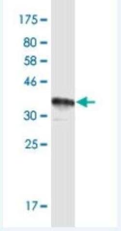 MUC12 Antibody (8B10), Novus Biologicals 100 &mu;g;, Unconjugated:Antibodies,