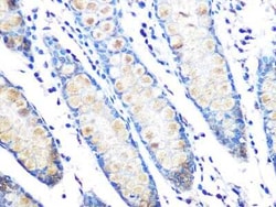 MUC2 Rabbit anti-Human, Mouse, Rat, Clone: 4L5Y8, Novus Biologicals:Antibodies:Primary