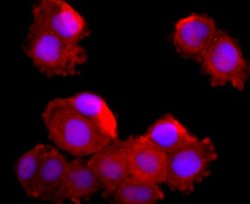 MUC2 Rabbit anti-Human, Clone: JA10-92, Novus Biologicals 100&mu;L:Antibodies,
