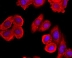 MUC2 Rabbit anti-Human, Clone: JA10-92, Novus Biologicals 100&mu;L:Antibodies,