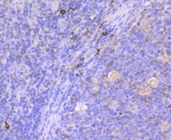 MUC2 Rabbit anti-Human, Clone: JA10-92, Novus Biologicals 100&mu;L:Antibodies,