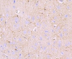 MUC2 Rabbit anti-Human, Clone: JA10-92, Novus Biologicals 100&mu;L:Antibodies,