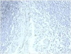 MUC5AC Rabbit anti-Human, Clone: MUC5AC/7067R, Novus Biologicals:Antibodies:Primary