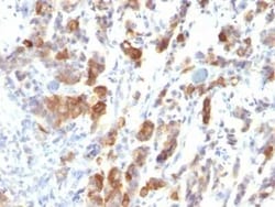 MUC5AC Antibody (MUC5AC/917), Novus Biologicals 0.1mg; Unlabeled:Antibodies,