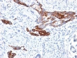 MUC6 Antibody (MUC6/1553R) - Azide and BSA Free, Novus Biologicals 100 &mu;g | Buy Online | Novus Biologicals | Fisher Scientific