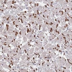 MUM1 Antibody, Novus Biologicals:Antibodies:Primary Antibodies