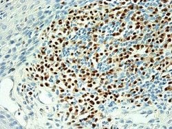 MUM1 Antibody (MUM1p), Novus Biologicals:Antibodies:Primary Antibodies