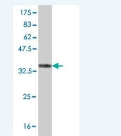 MURF3 Antibody (2G9), Novus Biologicals 0.1 mg; Unconjugated:Antibodies,