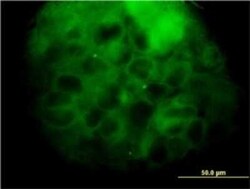 MVD Antibody (2A7), Novus Biologicals 0.1 mg | Buy Online | Novus Biologicals | Fisher Scientific