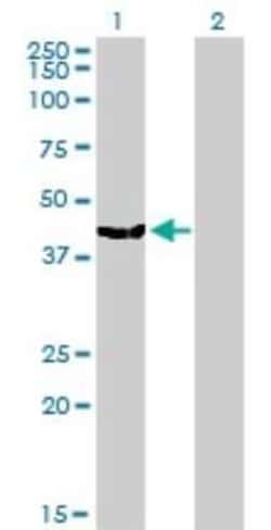 MVD Antibody (2A7), Novus Biologicals 0.1 mg | Buy Online | Novus Biologicals | Fisher Scientific