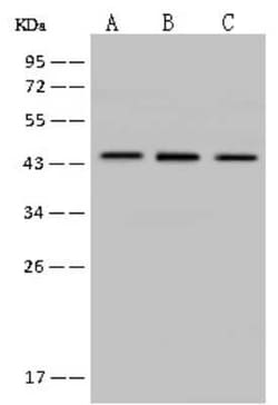 MVD Antibody, Novus Biologicals 100 &mu;g, Unconjugated:Antibodies, Polyclonal
