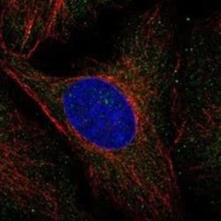 MVK Rabbit anti-Human, Polyclonal, Novus Biologicals:Antibodies:Primary