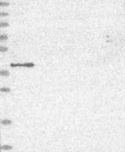MVK Rabbit anti-Human, Polyclonal, Novus Biologicals:Antibodies:Primary