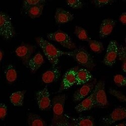 MVP Antibody (1014), Novus Biologicals:Antibodies:Primary Antibodies