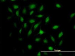 MX2 Antibody, Novus Biologicals 0.05 mg | Buy Online | Novus Biologicals | Fisher Scientific