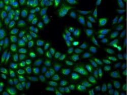 MXRA7 Antibody, Novus Biologicals 100 &mu;g; Unconjugated:Antibodies, Polyclonal