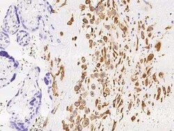 MXRA7 Antibody, Novus Biologicals 100 &mu;g; Unconjugated:Antibodies, Polyclonal