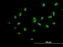 MYBBP1A Antibody, Novus Biologicals 0.05 mg | Buy Online | Novus Biologicals | Fisher Scientific