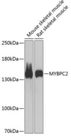 MYBPC2 Antibody - BSA Free, Novus Biologicals 0.02 mL; Unconjugated:Antibodies,