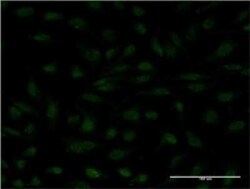 MYCBP Antibody (1F10), Novus Biologicals 0.1 mg | Buy Online | Novus Biologicals | Fisher Scientific