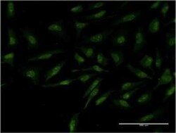 MYCBP Antibody (2E9), Novus Biologicals 0.1 mg | Buy Online | Novus Biologicals | Fisher Scientific