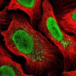 MYCBP2 Antibody, Novus Biologicals 25ul; Unconjugated:Antibodies, Polyclonal