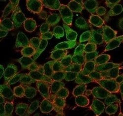 MYCL1/L-Myc Mouse anti-Human, Clone: PCRP-MYCL-2D5, Novus Biologicals 20