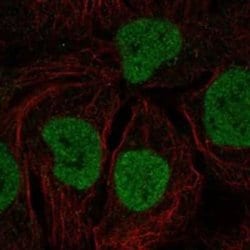 MYCL1/L-Myc Rabbit anti-Human, Polyclonal, Novus Biologicals:Antibodies:Primary