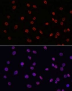 MYCT1 Antibody - Azide and BSA Free, Novus Biologicals 100 &mu;g; Unconjugated:Antibodies,