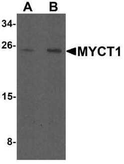 MYCT1 Antibody - BSA Free, Novus Biologicals 0.1 mg; Unconjugated:Antibodies,