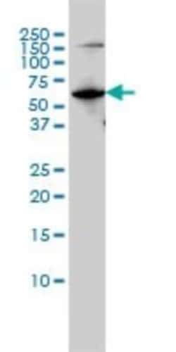 MYH Antibody (4D10), Novus Biologicals 0.1 mg; Unconjugated:Antibodies,