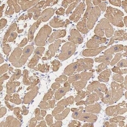 MYH6 Antibody, Novus Biologicals:Antibodies:Primary Antibodies
