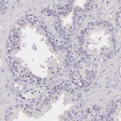 MYH6 Antibody, Novus Biologicals:Antibodies:Primary Antibodies