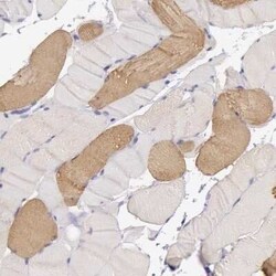MYH6 Antibody, Novus Biologicals:Antibodies:Primary Antibodies