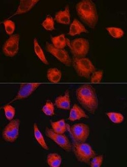 MYH7 Antibody - Azide and BSA Free, Novus Biologicals 0.1 mL; Unconjugated:Antibodies,