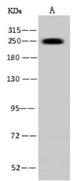 MYH7 Antibody, Novus Biologicals 100 &mu;g, Unconjugated:Antibodies, Polyclonal