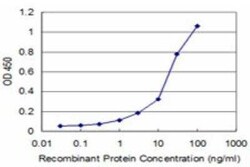 MYL5 Antibody (3D12), Novus Biologicals 0.1 mg | Buy Online | Novus Biologicals | Fisher Scientific