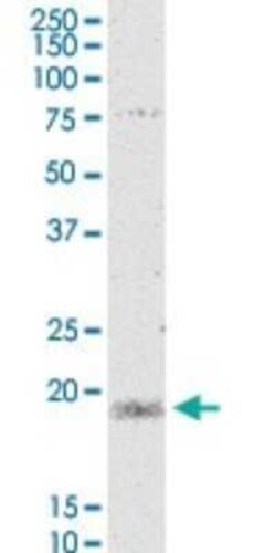 MYL5 Antibody (3D12), Novus Biologicals 0.1 mg | Buy Online | Novus Biologicals | Fisher Scientific