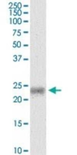 MYL5 Antibody (3D12), Novus Biologicals 0.1 mg | Buy Online | Novus Biologicals | Fisher Scientific