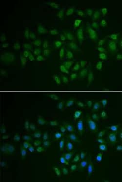 MYLK3 Antibody - Azide and BSA Free, Novus Biologicals:Antibodies:Primary