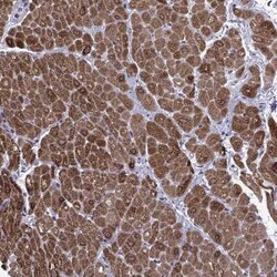 MYLK3 Antibody, Novus Biologicals 25 &mu;L | Buy Online | Novus Biologicals | Fisher Scientific