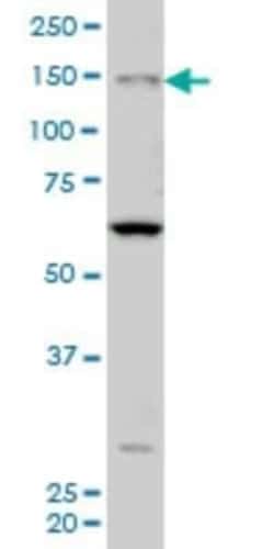 MYO3A Antibody (8H2), Novus Biologicals 0.05 mg | Buy Online | Novus Biologicals | Fisher Scientific