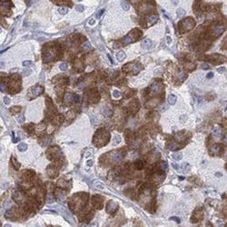 MYO3A Rabbit anti-Human, Polyclonal, Novus Biologicals 100 &mu;g; Unconjugated:Antibodies,