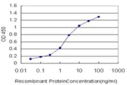 MYPN Antibody (4C8), Novus Biologicals 0.1 mg; Unconjugated:Antibodies,