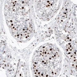 Macro H2A.2 Antibody (CL5263), Novus Biologicals 25 &mu;L:Antibodies, Monoclonal