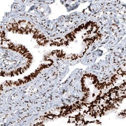 Macro H2A.2 Antibody (CL5263), Novus Biologicals 25 &mu;L:Antibodies, Monoclonal