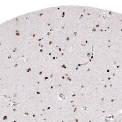 Macro H2A.2 Antibody (CL5263), Novus Biologicals 25 &mu;L:Antibodies, Monoclonal