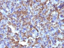 Macrophage and Histiocytoma Marker Antibody (D11), Novus Biologicals:Antibodies:Primary