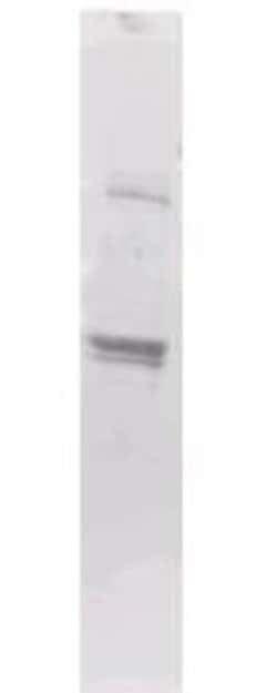 Maltose Binding Protein Antibody - BSA Free, Novus Biologicals 1 mg | Buy Online | Novus Biologicals | Fisher Scientific